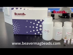 BeaverBeads petzen RNS Kit Extract Nucleic Acid Excellent-Stabilität
