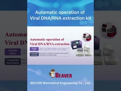 BeaverBeadsTM Nukleinsäure Extraktion und Reinigung Kit Magnetische Perlen Methode für die Extraktion