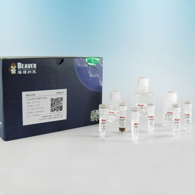Viren-DNA-RNS Kit Nucleic Acid Extraction Kits für Virennukleinsäure-Extraktions-Flaschen